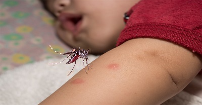 Muỗi đốt tuy ít gây dị ứng nghiêm trọng nhưng là là con đường lây truyền những căn bệnh nguy hiểm cho trẻ.