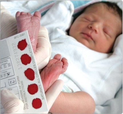 Tầm soát thiếu men G6PD cho trẻ sơ sinh.
