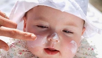 Những điều cần biết khi sử dụng kem dưỡng ẩm cho bé bị chàm